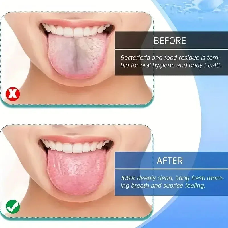 Stainless Steel Tongue Scraper
